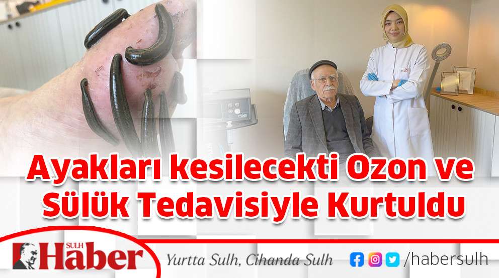 Ayakları kesilecekti Ozon ve Sülük Tedavisiyle Kurtuldu
