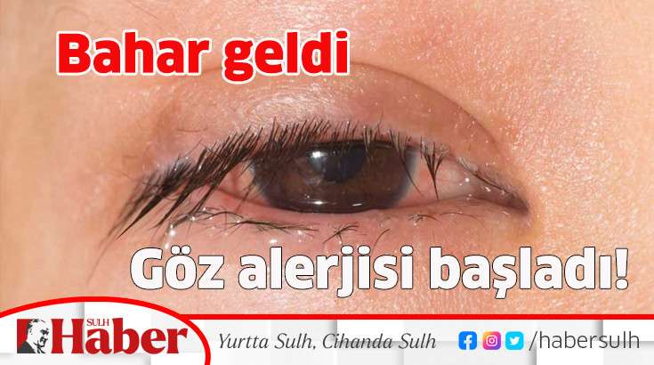 BAHAR GELDİ,GÖZ ALERJİSİ BAŞLADI