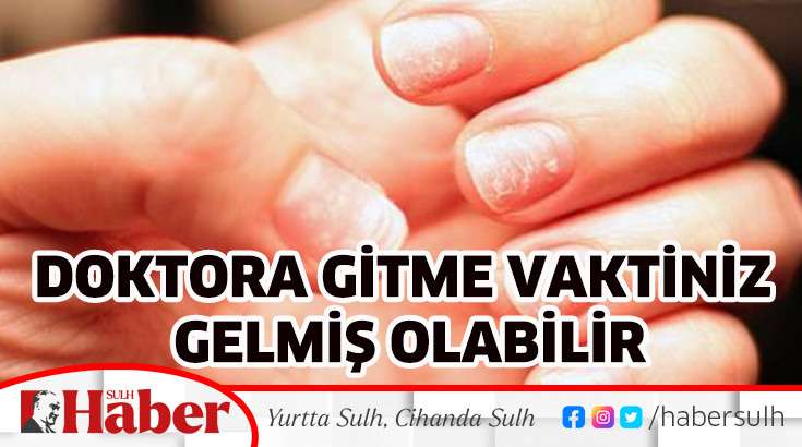 DOKTORA GİTME VAKTİNİZ GELMİŞ OLABİLİR